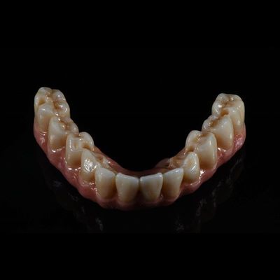 Qualität  Fixed Restorations Full Arch Zirconia Implant Bridge Denture Teeth usine