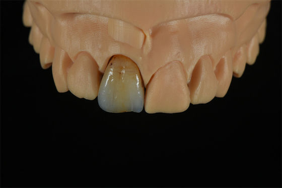 Qualität  Affordable Zirconia Crowns with Custom Color Staining - China Dental Lab usine